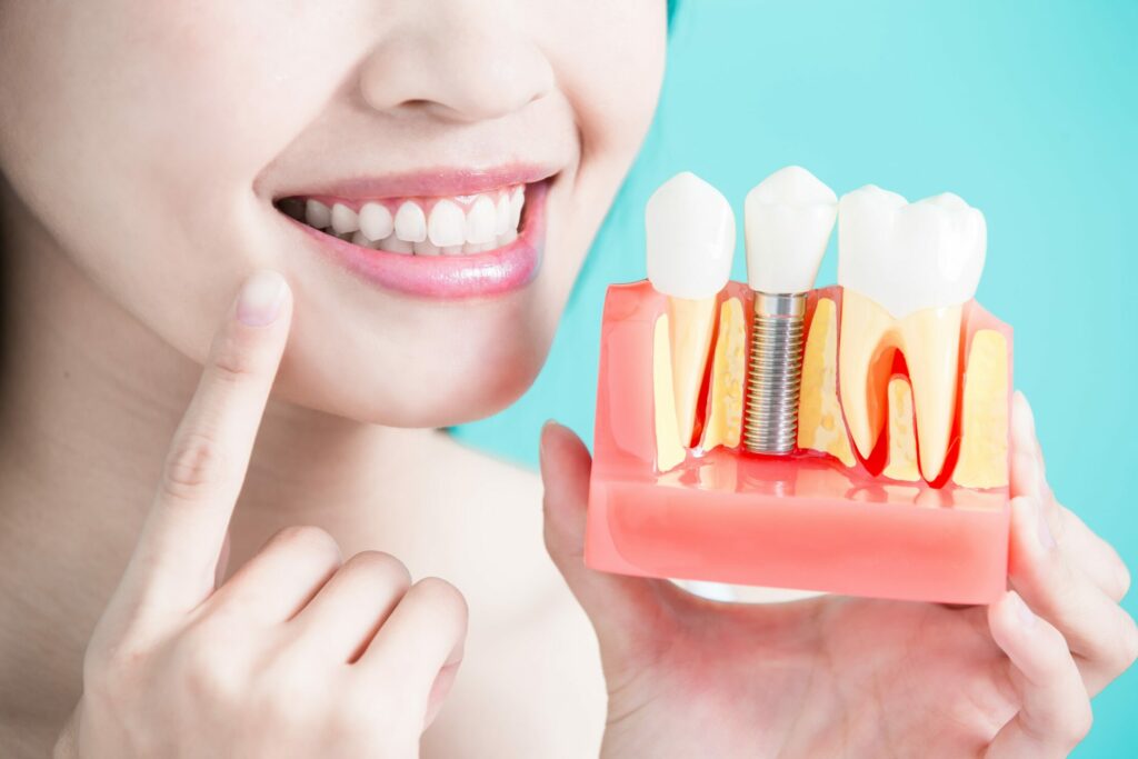 dental implant woman modal