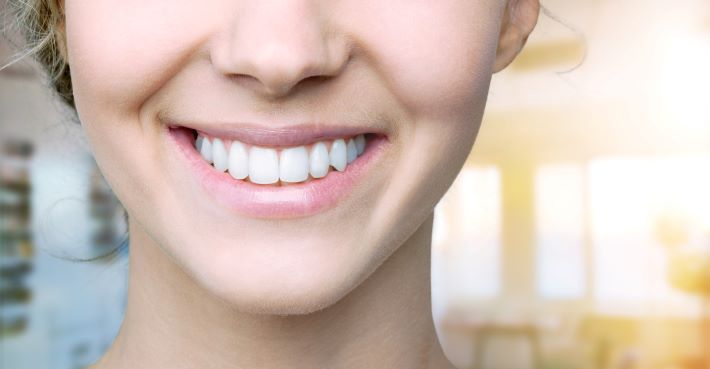 woman smiling with straight teeth